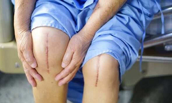 Pain After Surgery or Injury: What Is Normal?
