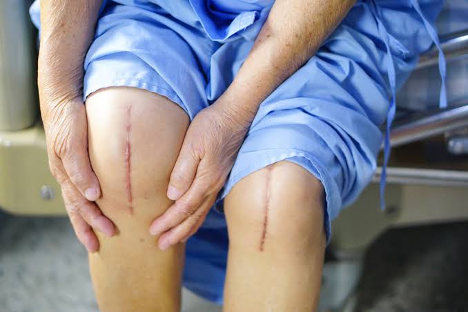 Pain After Surgery or Injury: What Is Normal?